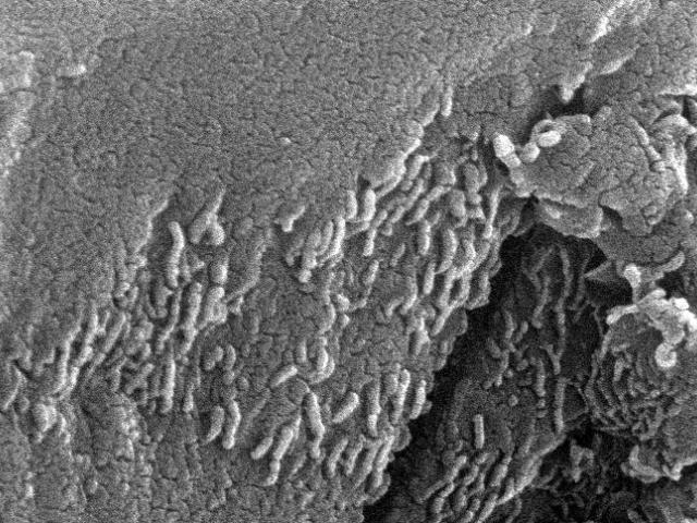 Early Microscopic Life on Mars?