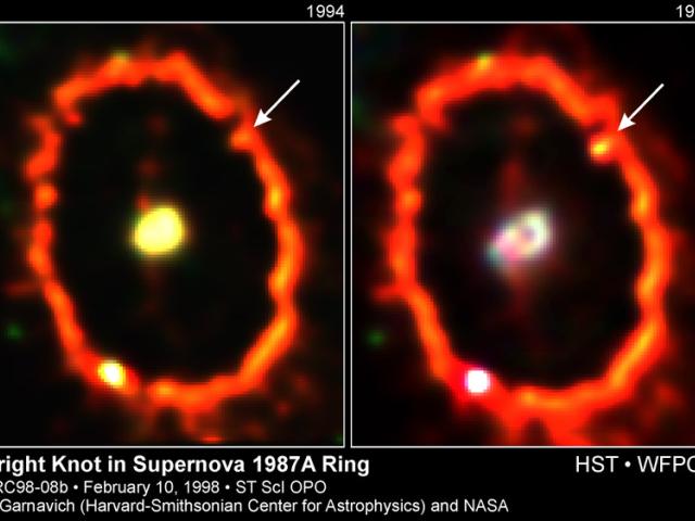 Shocked by Supernova 1987a