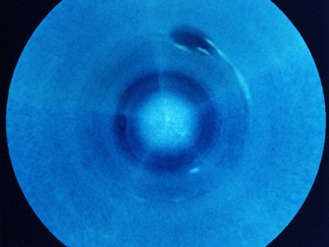 Southern Neptune