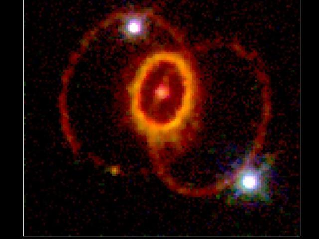 The Mysterious Rings of Supernova 1987A