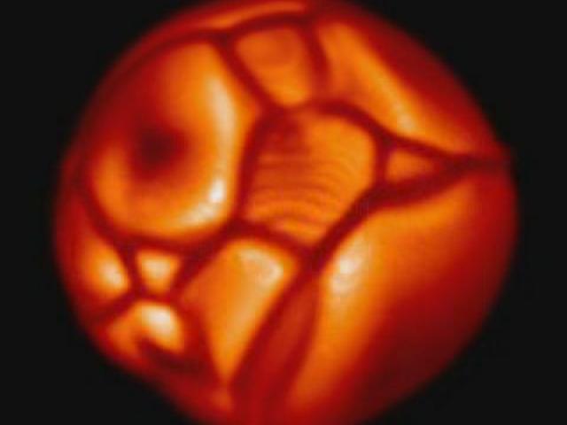 Simulated Supergiant Star