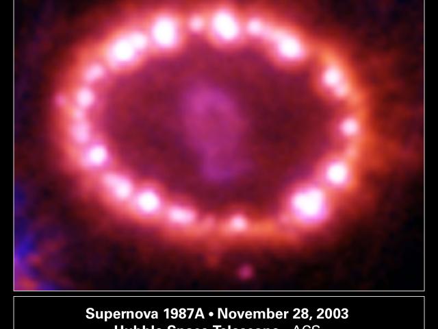 SN1987A’s Cosmic Pearls
