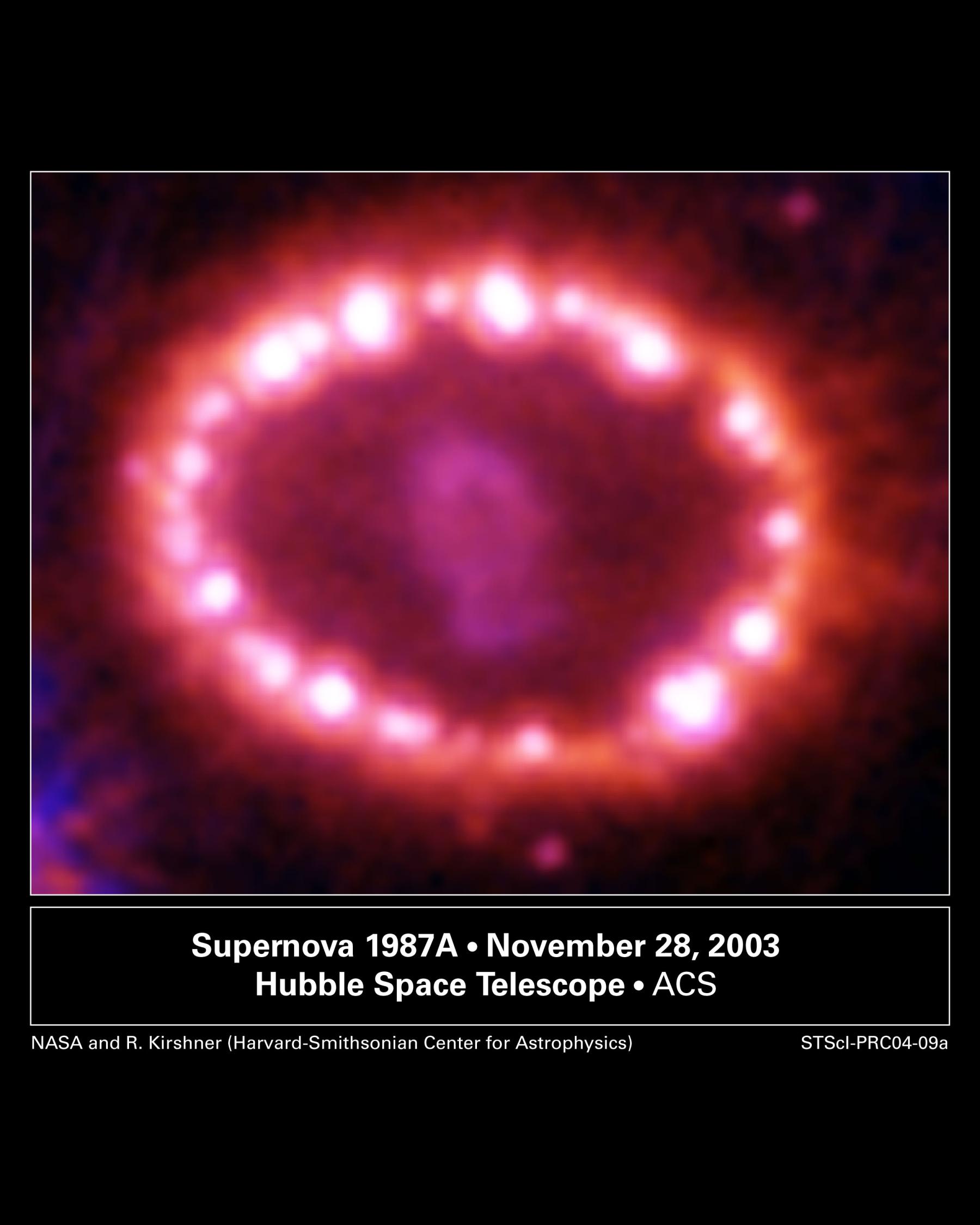 SN1987A’s Cosmic Pearls