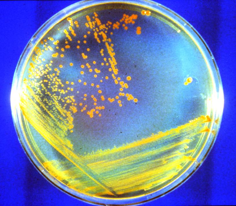 D rad Bacteria: Candidate Astronauts