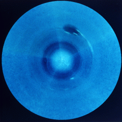 Southern Neptune