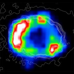 X-Ray Ring Around SN1987A